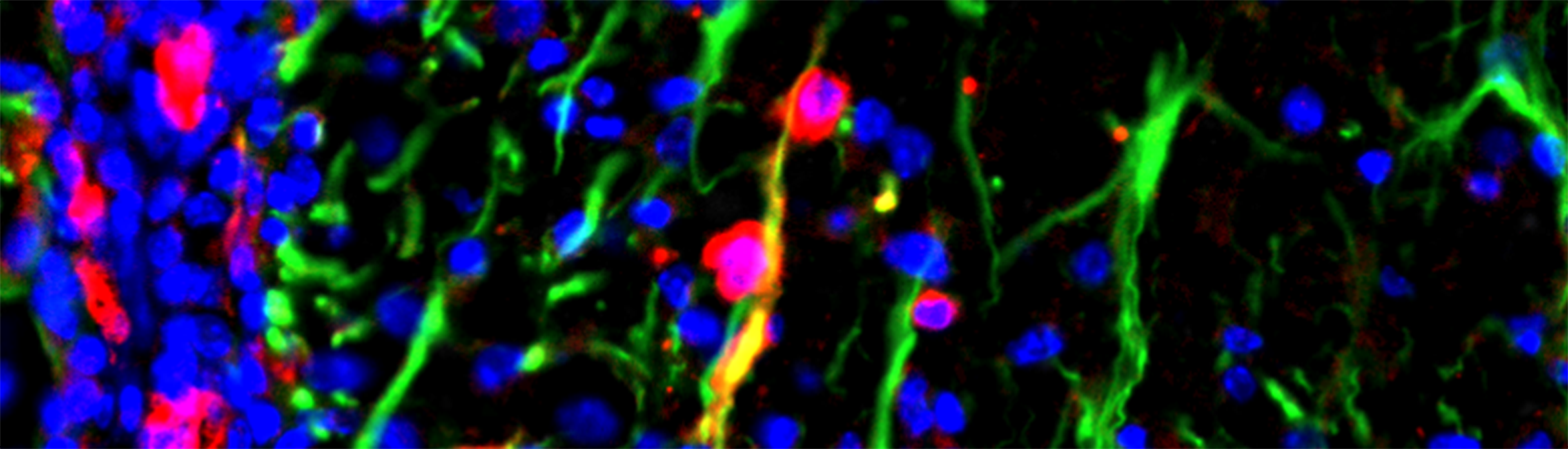 新研究揭示星形胶质细胞多巴胺受体D2在神经系统自身免疫性疾病中的作用