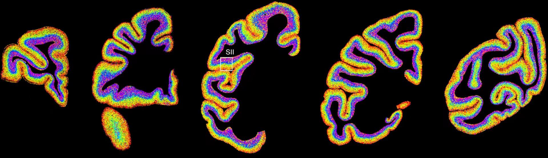世界首套单细胞分辨率的猕猴大脑皮层细胞空间分布图谱发布